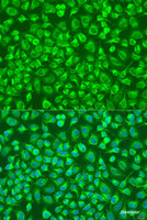 Immunofluorescence analysis of U2OS cells using ENTPD5 Polyclonal Antibody at dilution of 1:100. Blue: DAPI for nuclear staining.