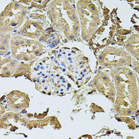 Immunohistochemistry of paraffin-embedded Rat kidney using CDH6 Polyclonal Antibody at dilution of 1:100 (40x lens) .