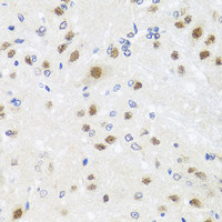 Immunohistochemistry of paraffin-embedded Rat brain using CETN3 Polyclonal Antibody at dilution of 1:100 (40x lens) .