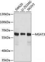 Western blot analysis of extracts of various cell lines using MGAT3 Polyclonal Antibody at dilution of 1:1000.