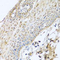 Immunohistochemistry of paraffin-embedded Human esophagus using NDUFA2 Polyclonal Antibody at dilution of 1:100 (40x lens) .