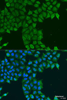 Immunofluorescence analysis of U2OS cells using CDK16 Polyclonal Antibody at dilution of 1:100. Blue: DAPI for nuclear staining.