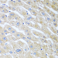 Immunohistochemistry of paraffin-embedded Human liver using UCHL3 Polyclonal Antibody at dilution of 1:100 (40x lens) .