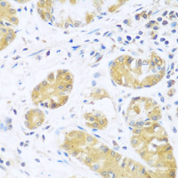 Immunohistochemistry of paraffin-embedded Human stomach using UCHL3 Polyclonal Antibody at dilution of 1:100 (40x lens) .