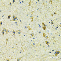 Immunohistochemistry of paraffin-embedded Mouse spinal cord using SLC25A11 Polyclonal Antibody at dilution of 1:100 (40x lens) .
