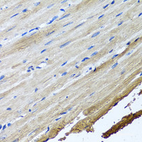 Immunohistochemistry of paraffin-embedded Rat heart using TTLL12 Polyclonal Antibody at dilution of 1:100 (40x lens) .