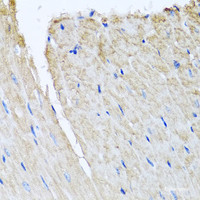 Immunohistochemistry of paraffin-embedded Mouse heart using TTLL12 Polyclonal Antibody at dilution of 1:100 (40x lens) .