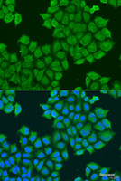 Immunofluorescence analysis of U2OS cells using STX12 Polyclonal Antibody at dilution of 1:100. Blue: DAPI for nuclear staining.