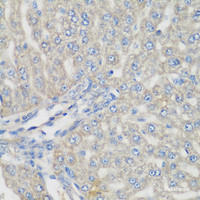 Immunohistochemistry of paraffin-embedded Rat liver using METTL7A Polyclonal Antibody at dilution of 1:200 (40x lens) .