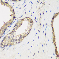 Immunohistochemistry of paraffin-embedded Human prostate using METTL7A Polyclonal Antibody at dilution of 1:200 (40x lens) .
