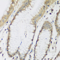 Immunohistochemistry of paraffin-embedded Human stomach using METTL7A Polyclonal Antibody at dilution of 1:200 (40x lens) .