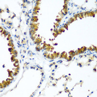 Immunohistochemistry of paraffin-embedded Mouse lung using TAZ Polyclonal Antibody at dilution of 1:200 (40x lens) .