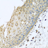 Immunohistochemistry of paraffin-embedded Human esophagus using ARFGAP3 Polyclonal Antibody at dilution of 1:100 (40x lens) .
