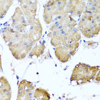 Immunohistochemistry of paraffin-embedded Human stomach using NIN Polyclonal Antibody at dilution of 1:100 (40x lens) .