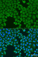 Immunofluorescence analysis of U2OS cells using AGGF1 Polyclonal Antibody at dilution of 1:100. Blue: DAPI for nuclear staining.