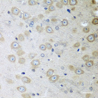 Immunohistochemistry of paraffin-embedded Mouse brain using ATAD3A Polyclonal Antibody at dilution of 1:100 (40x lens) .