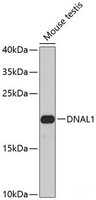 Western blot analysis of extracts of Mouse testis using DNAL1 Polyclonal Antibody at dilution of 1:1000.