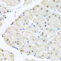 Immunohistochemistry of paraffin-embedded Human stomach using DNAL1 Polyclonal Antibody at dilution of 1:100 (40x lens) .