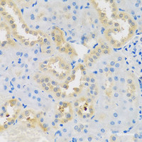 Immunohistochemistry of paraffin-embedded Rat kidney using DNAL1 Polyclonal Antibody at dilution of 1:100 (40x lens) .