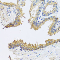 Immunohistochemistry of paraffin-embedded Human prostate using ARL6 Polyclonal Antibody at dilution of 1:100 (40x lens) .