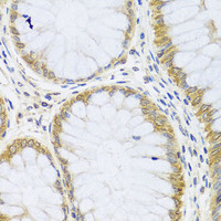 Immunohistochemistry of paraffin-embedded Human colon using ARL6 Polyclonal Antibody at dilution of 1:100 (40x lens) .