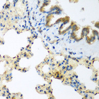 Immunohistochemistry of paraffin-embedded Rat lung using LLGL2 Polyclonal Antibody at dilution of 1:200 (40x lens) .