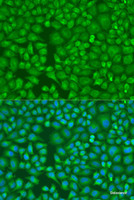 Immunofluorescence analysis of U2OS cells using LLGL2 Polyclonal Antibody at dilution of 1:100. Blue: DAPI for nuclear staining.