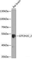 Western blot analysis of extracts of Rat brain using GTF2H2C_2 Polyclonal Antibody at dilution of 1:1000.