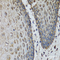 Immunohistochemistry of paraffin-embedded Human esophagus using IL36G Polyclonal Antibody at dilution of 1:100 (40x lens) .