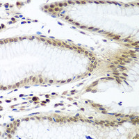 Immunohistochemistry of paraffin-embedded Human stomach using PTTG1 Polyclonal Antibody at dilution of 1:100 (40x lens) .