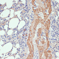 Immunohistochemistry of paraffin-embedded Rat lung using WNT5B Polyclonal Antibody at dilution of 1:100 (40x lens) .