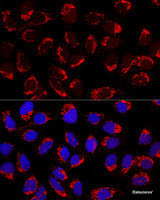 Confocal immunofluorescence analysis of U2OS cells using AP1M2 Polyclonal Antibody at dilution of 1:200. Blue: DAPI for nuclear staining.