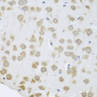 Immunohistochemistry of paraffin-embedded Mouse brain using GRPEL2 Polyclonal Antibody at dilution of 1:100 (40x lens) .