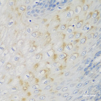 Immunohistochemistry of paraffin-embedded Human esophagus using NME4 Polyclonal Antibody at dilution of 1:100 (40x lens) .