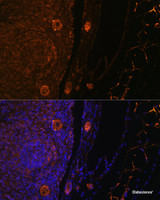 Immunofluorescence analysis of Rat oophoroma cells using ZP3 Polyclonal Antibody at dilution of 1:100. Blue: DAPI for nuclear staining.