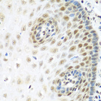 Immunohistochemistry of paraffin-embedded Human esophagus using MDC1 Polyclonal Antibody at dilution of 1:100 (40x lens) .