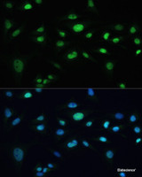 Immunofluorescence analysis of U-2 OS cells using MDC1 Polyclonal Antibody at dilution of 1:100. Blue: DAPI for nuclear staining.