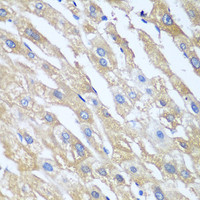 Immunohistochemistry of paraffin-embedded Human liver using PPP4R1 Polyclonal Antibody at dilution of 1:100 (40x lens) .