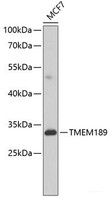 Western blot analysis of extracts of MCF-7 cells using TMEM189 Polyclonal Antibody at dilution of 1:1000.