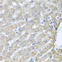 Immunohistochemistry of paraffin-embedded Human liver using TMEM189 Polyclonal Antibody at dilution of 1:100 (40x lens) .