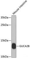 Western blot analysis of extracts of Mouse small intestine using GUCA2B Polyclonal Antibody at dilution of 1:1000.