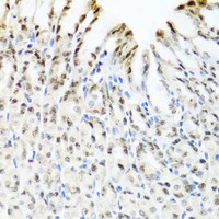 Immunohistochemistry of paraffin-embedded Mouse stomach using YTHDF3 Polyclonal Antibody at dilution of 1:100 (40x lens) .