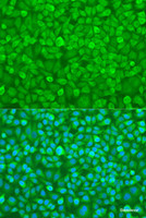 Immunofluorescence analysis of U2OS cells using YTHDF3 Polyclonal Antibody at dilution of 1:100. Blue: DAPI for nuclear staining.