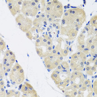 Immunohistochemistry of paraffin-embedded Human stomach using ALAD Polyclonal Antibody at dilution of 1:100 (40x lens) .