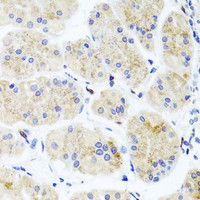 Immunohistochemistry of paraffin-embedded Human stomach using ATP7A Polyclonal Antibody at dilution of 1:100 (40x lens) .