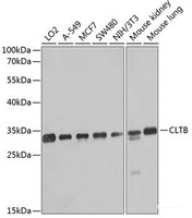 Western blot analysis of extracts of various cell lines using CLTB Polyclonal Antibody at dilution of 1:1000.