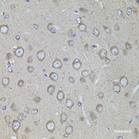 Immunohistochemistry of paraffin-embedded Rat brain using CRHR1 Polyclonal Antibody at dilution of 1:100 (40x lens) .