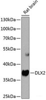 Western blot analysis of extracts of Rat brain using DLX2 Polyclonal Antibody at dilution of 1:1000.