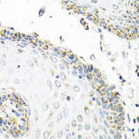 Immunohistochemistry of paraffin-embedded Human esophagus using GNRH2 Polyclonal Antibody at dilution of 1:100 (40x lens) .