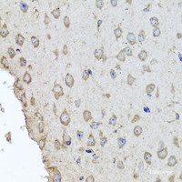 Immunohistochemistry of paraffin-embedded Mouse brain using HBA2 Polyclonal Antibody at dilution of 1:100 (40x lens) .
